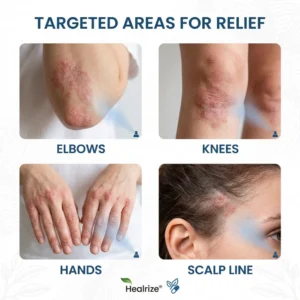 Healrize® Magnesium Botanical Spray