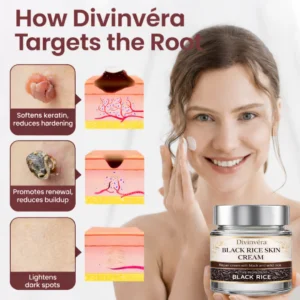 Divinvéra Black Rice Skin Cream